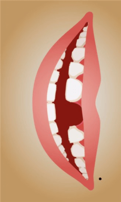 Скриншот приложения Big Mouth Free - №4