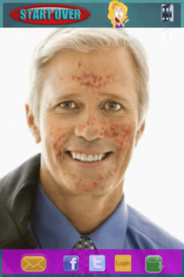 Скриншот приложения Acne Pimples Kiosk © HD Lite - №6