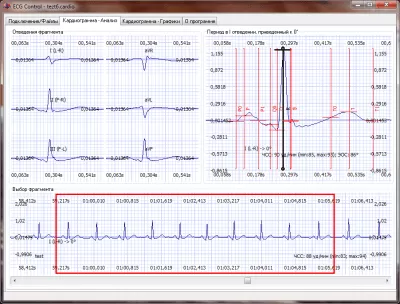 Скриншот приложения ECG Control - №1