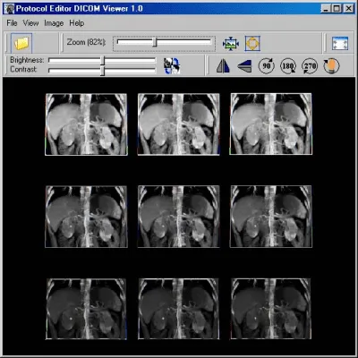 Скриншот приложения DICOM Viewer - №1