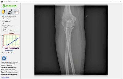 Скриншот приложения Lim DICOM Viewer - №1