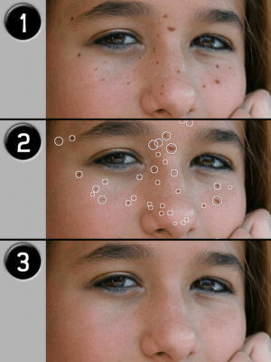 Скриншот приложения Pimple Eraser LITE - №3