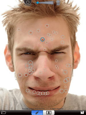 Скриншот приложения Pimple Eraser LITE - №4