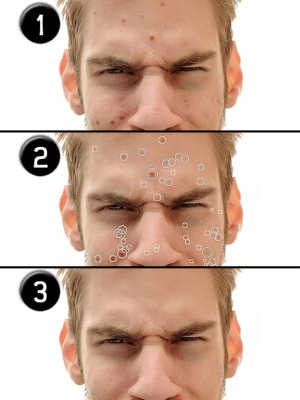 Скриншот приложения Pimple Eraser LITE - №5