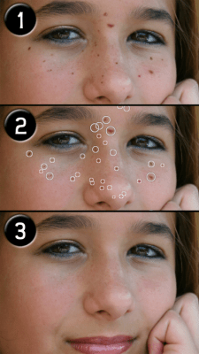 Скриншот приложения Pimple Eraser LITE - №8