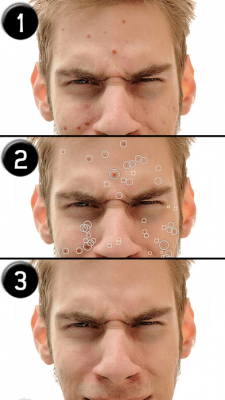 Скриншот приложения Pimple Eraser LITE - №10