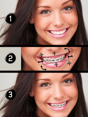 Скриншот приложения Brace Face - №5