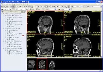 Скриншот приложения Escape Medical Viewer - №1